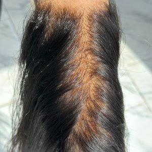 Hd Frontal / Closure